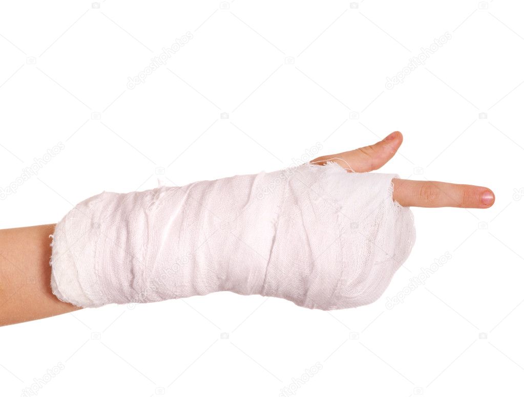 Cast On Arm