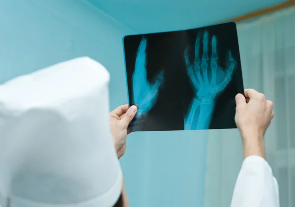 Doctor watches X ray film