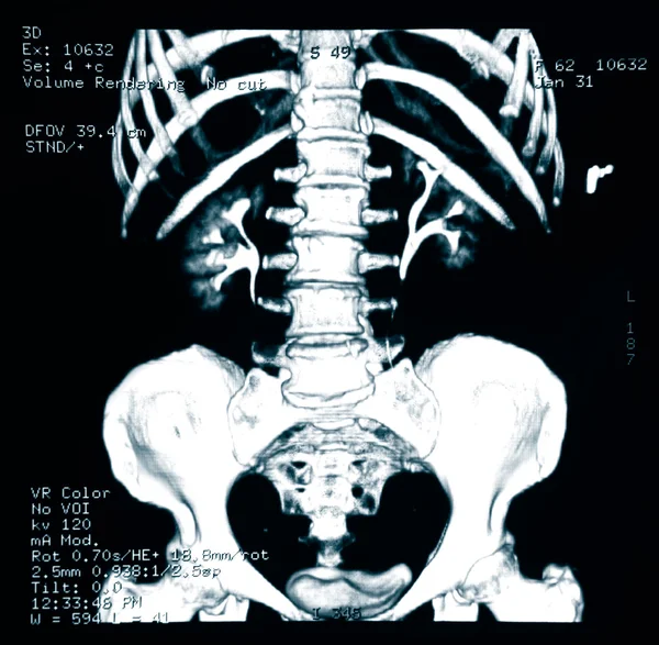 X-ray of the pelvis and spinal column