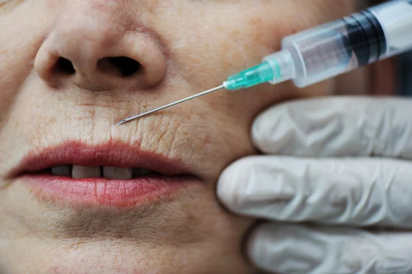 Needle injection on mature woman face