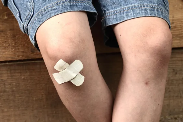 Bruise on the boy\'s leg