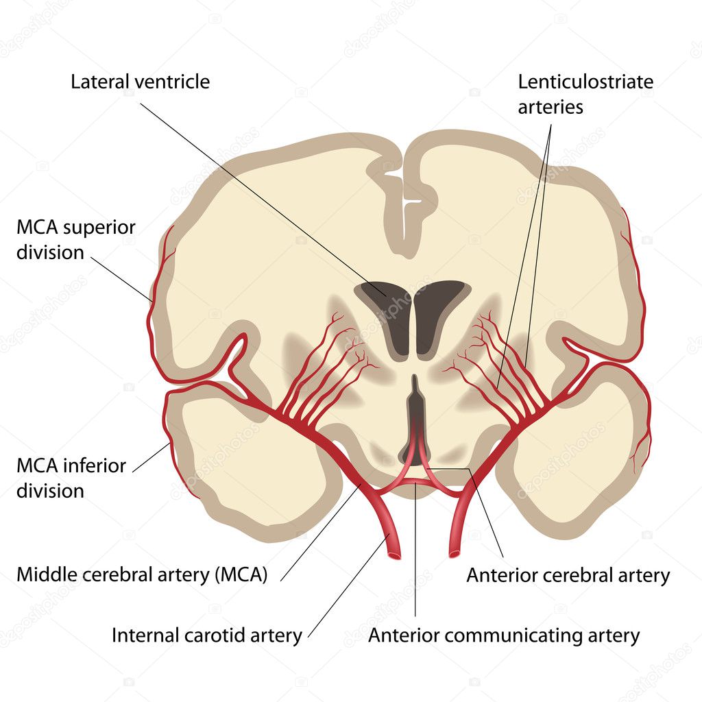 Lenticulostriate Arteries