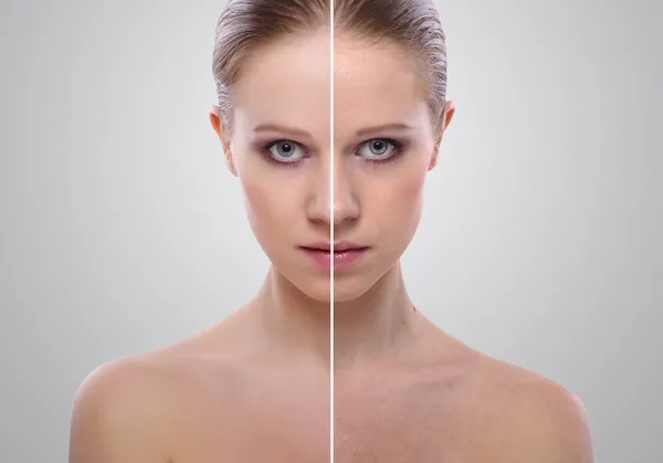 Effect of healing of skin, beauty young woman before and after t