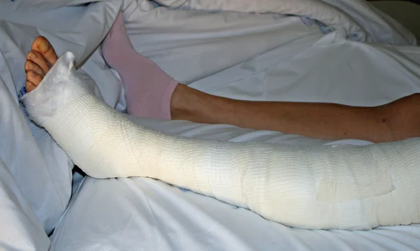 Foot and leg bandaged after surgery
