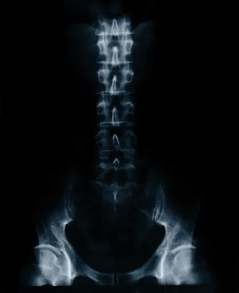 X-RAY film of male lower thorax and pelvis