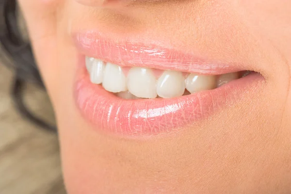 Beauty woman smile, white teeth and lips closeup,health care, dentist adver