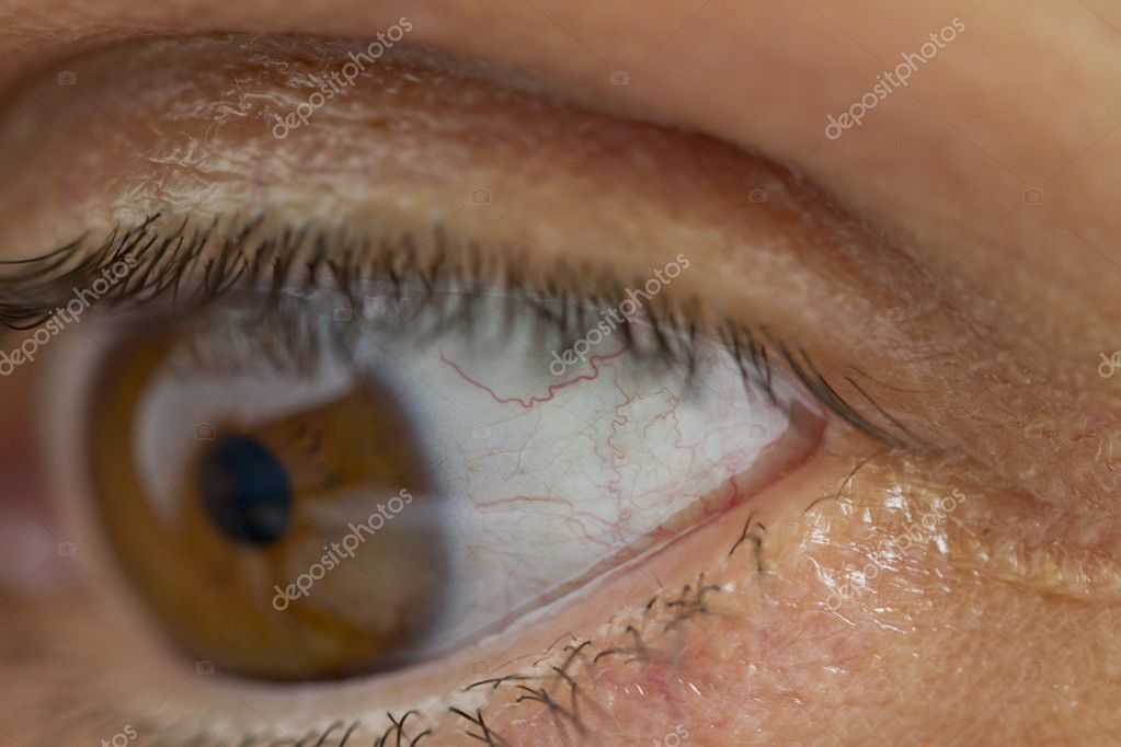 eye-veins