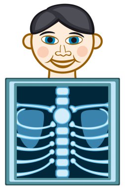 X-ray clipart