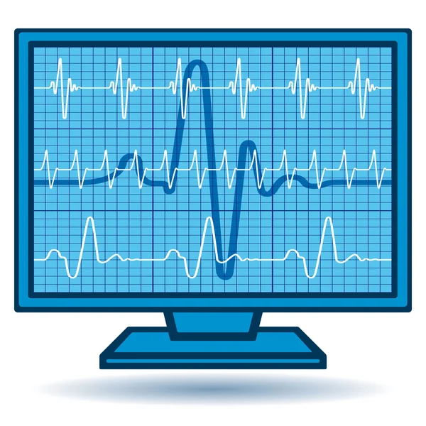 Kardiogramm-Monitor — Stockvektor