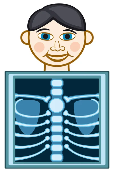 Radiographie — Image vectorielle