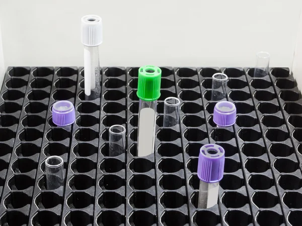 Test tubes — Stock Photo, Image