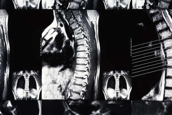 Röntgenkuva — kuvapankkivalokuva