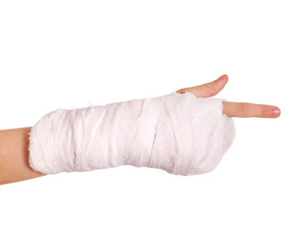 Gebroken arm in een cast — Stockfoto