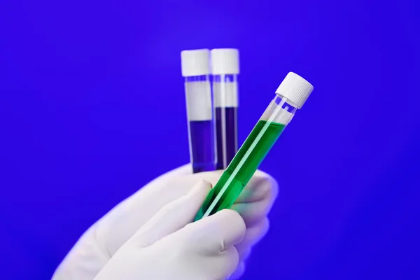 Medical test tubes with fluid sample closeup in gloved hand on b — Stock Photo, Image