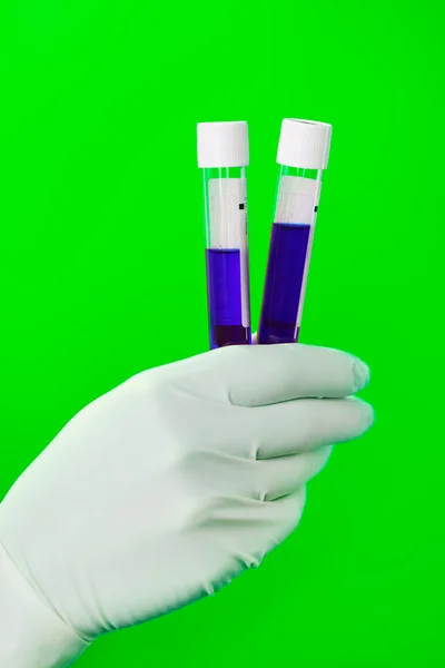 Medical test tubes with fluid sample closeup in gloved hand — Stock Photo, Image