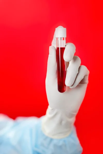 Medical test tubes with fluid sample closeup in gloved hand on r — Stock Photo, Image