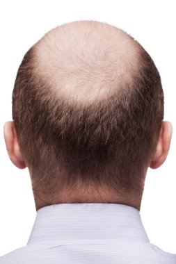 Bald man head clipart