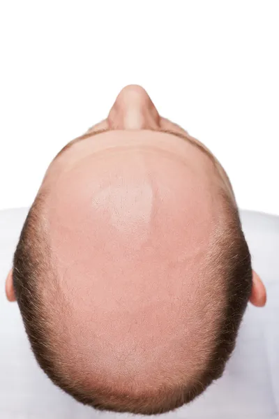 Κεφάλι του φαλακρός άνδρας — Φωτογραφία Αρχείου