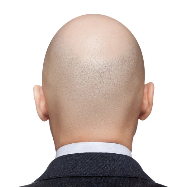 Κεφάλι του φαλακρός άνδρας Εικόνα Αρχείου