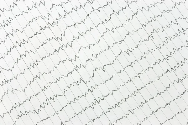 stock image The electrocardiogram of heart