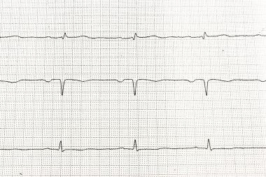 Electrocardiogram heart clipart