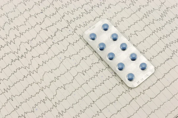 Tablety na elektrokardiogramu. — Stock fotografie