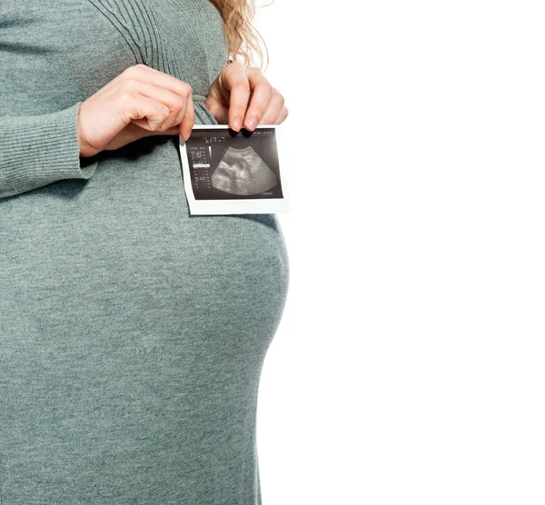 Mulher grávida segurando imagem de ultra-som — Fotografia de Stock