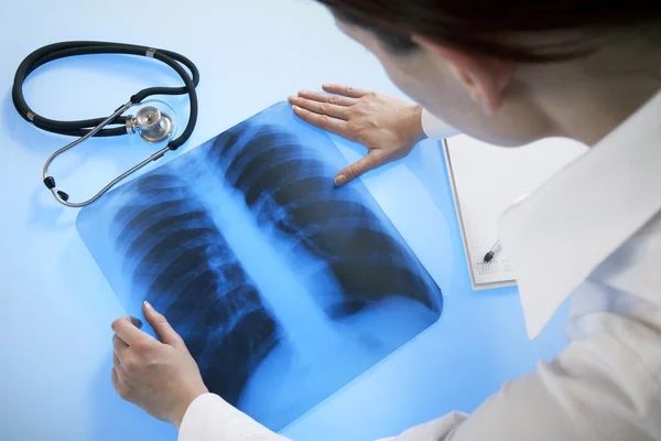 Доктор с рентгеновским снимком — стоковое фото
