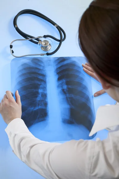 Доктор з рентгенівським зображенням — стокове фото