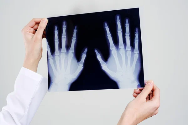 Röntgenaufnahmen — Stockfoto