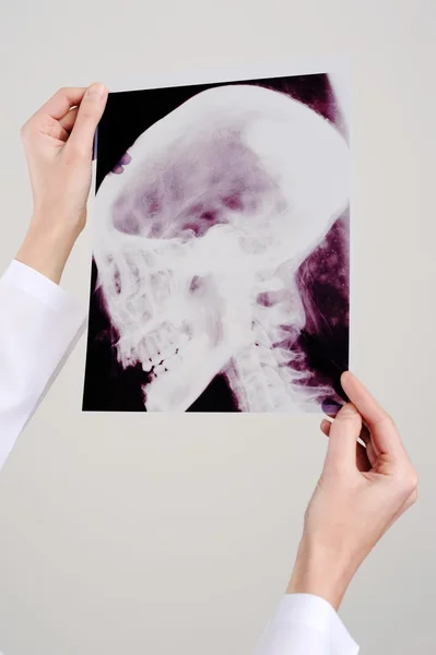 Проведення рентген — стокове фото