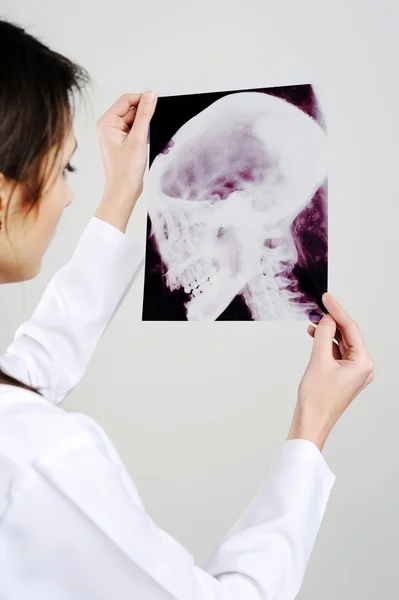Arzt untersucht Schädel-Röntgen — Stockfoto
