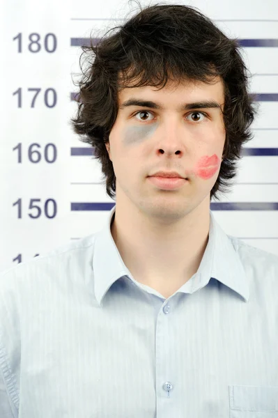 A man with a kiss and a bruise on his face — Stock Photo, Image