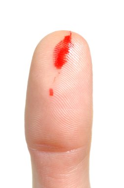 Bleeding from Cut Finger clipart