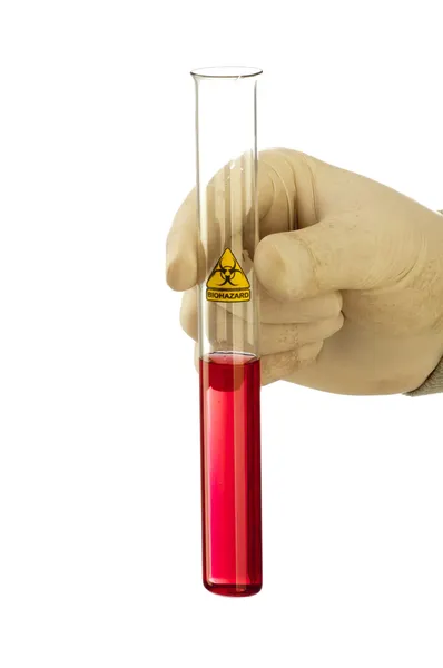 Mano sostiene tubo de vidrio con líquido rojo y símbolo de riesgo biológico . — Foto de Stock