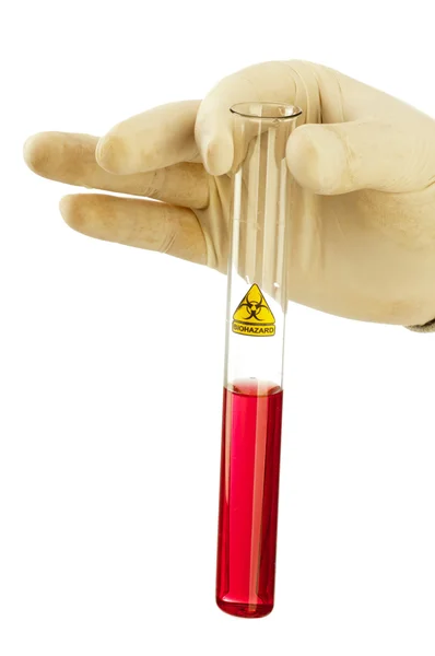 Mão segura tubo de vidro com fluido vermelho e símbolo de risco biológico . — Fotografia de Stock