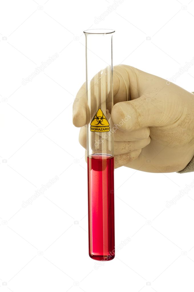 Hand holds glass tube with red fluid and symbol biohazard.