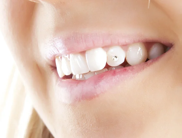 Smiling woman mouth with crystal in teeth. — Stock Photo, Image
