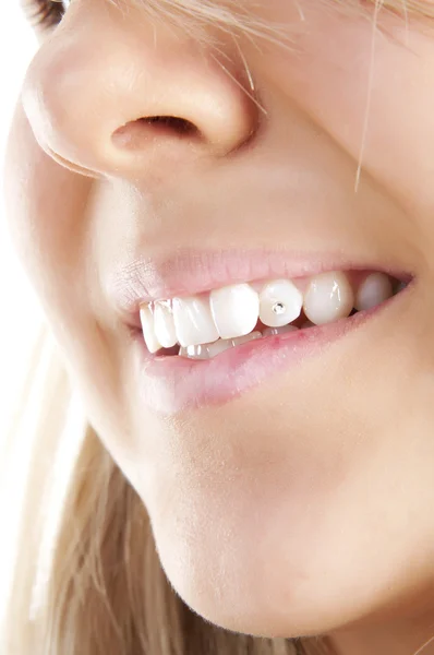 Mujer sonriente boca con cristal en los dientes . — Foto de Stock