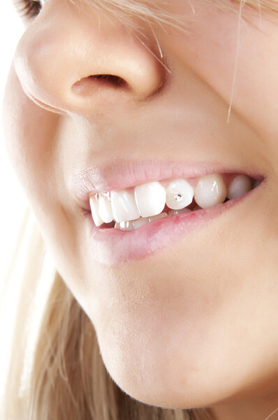 Smiling woman mouth with crystal in teeth.