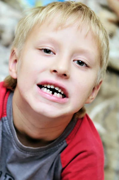 Bye bye first milk tooth — Stock Photo, Image