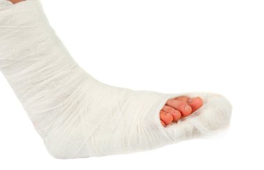 Leg in a plaster cast clipart