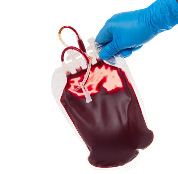Мешок с кровью в руке — стоковое фото
