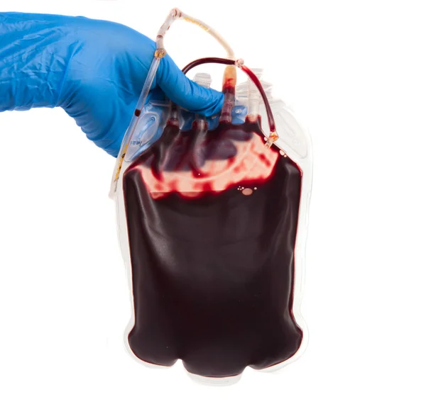 Мешок с кровью в руке — стоковое фото