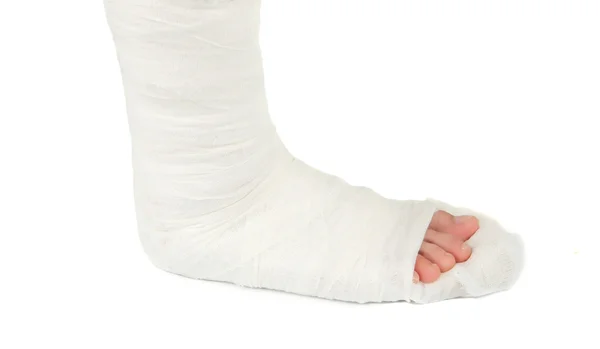 Leg in a plaster cast — Stock Photo, Image