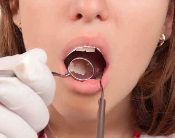 치과 치료 — 스톡 사진