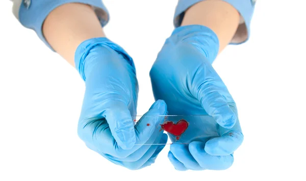 Tıbbi bir elinde kan analizi — Stok fotoğraf