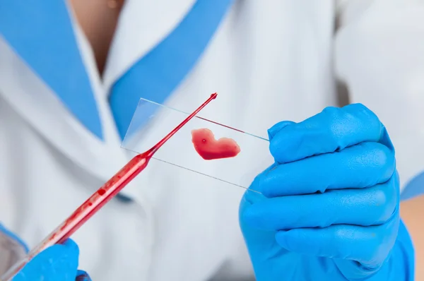 Analiza krwi — Zdjęcie stockowe