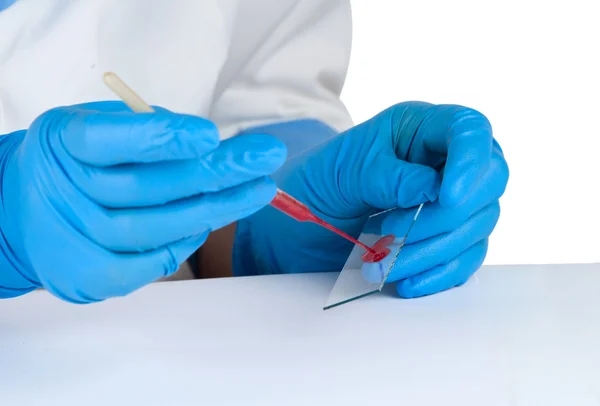 Analysis of blood in the hands of a medical — Stock Photo, Image