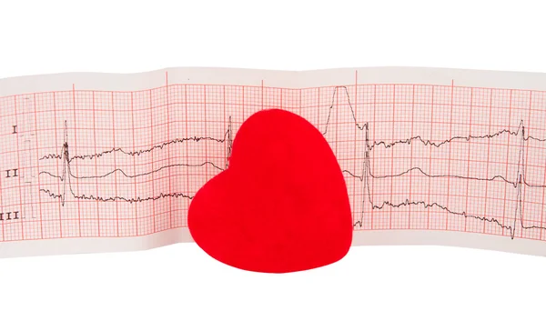 Elektrokardiogram z sercem — Zdjęcie stockowe